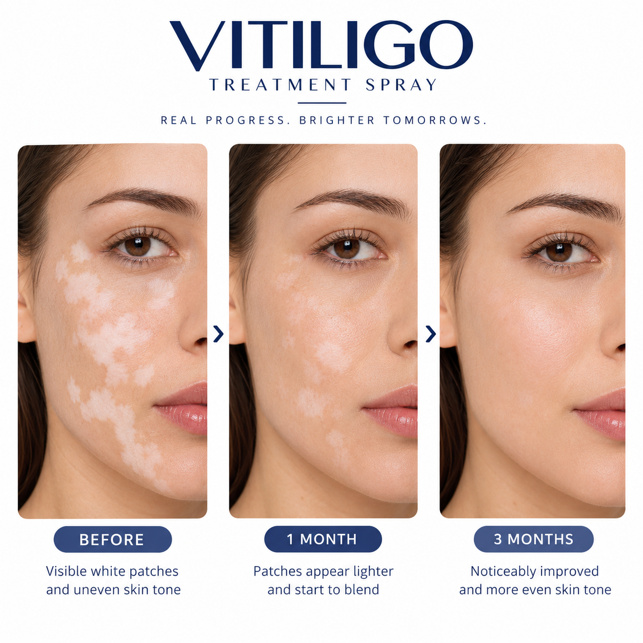 PixelTone™ skincare comparison graphic showing before, one month and three month routine stages